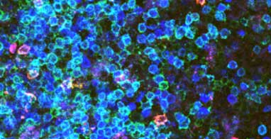 CD3 antibody and mamu-A1/Tat tetramer+ cells stained on axillary lymph nodes