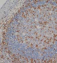CD3 antibody stained on human tonsil following heat mediated antigen retrieval