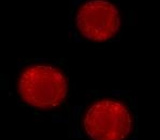 Staining of staurosporine-induced THP-1 cells using the Magic Red™ Cathepsin B kit 