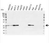 Western blot analysis of whole cell lysates probed with Bcl-2 antibody followed by detection with HRP conjugated Goat anti-mouse IgG (1/10,000, STAR207P) and visualized on the ChemiDoc MP with 67 second exposure. Arrow points to Bcl-2 (molecular weight 26 kDa