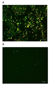 Fig.5. HeLa cells were incubated A) in the presence or B) in the absence of staurosporine to induce apoptosis.