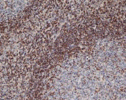 Fig. 2 Staining of paraffin embedded human tonsil with Mouse Anti-Human Bcl-2 (MCA1550).