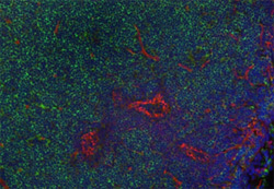Fig.3. Immunohistochemistry analysis of Human Cell Adhesion Marker CD31.  