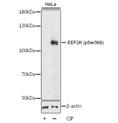 Western blot analysis of HeLa cell lysate untreated or treated with CIP using Rabbit Anti-EEF2K (pSer366) Antibody at a 1/1,000 dilution. 