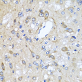 Immunohistochemistry of paraffin-embedded rat brain using Rabbit anti CD184/CXCR4 antibody