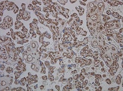 Placenta stained with mouse anti-human cd34