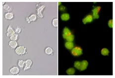 Lysosomes stained with acridine orange in normal Jurkat cells