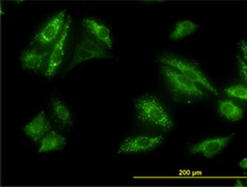 Fig. 4. Detection of p62 by immunofluorescence. 