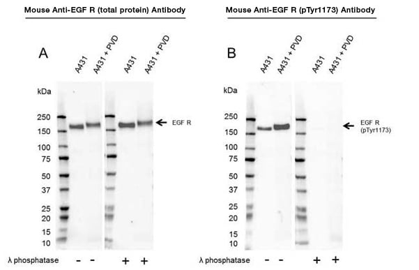 Fig. 1. Western blot analysis of whole cell lysates probed with A, Mouse Anti-EGF Receptor Antibody (VMA00061) or B, Mouse Anti-EGF Receptor (pTyr1173) Antibody (VMA00752). 