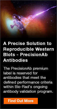 A Precise Solution to  Reproducible Western Blots - PrecisionAb  Antibodies