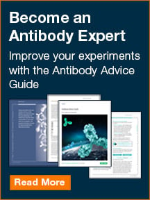Antibody Advice Guide - Free guide to become an antibody expert