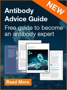 Free guide to become  an antibody expert
