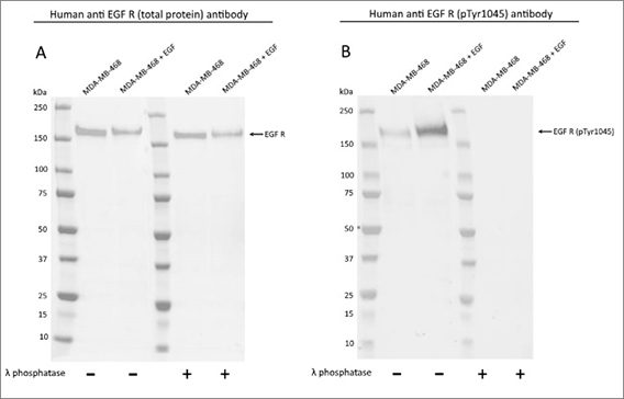 Fig. 1. Western blot detection of total and phospho EGF R. 