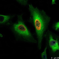 Fig. 1.  Proliferating HeLa cells treated with 100 μM BrdU and stained with recombinant PrecisionAb Human Anti-BrdU Antibody (HCA320) at a 1/500 dilution. 