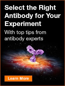 Select the Right Antibody for Your Experiment  - With top tips from antibody experts