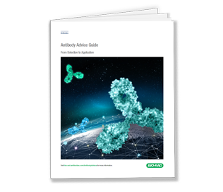 Antibody Advice Guide - Get Your Free Guide