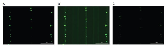 Fig. 3. Representative images of MCF-7 cells stained with anti-PanCK antibody and acquired at different parameters. 
