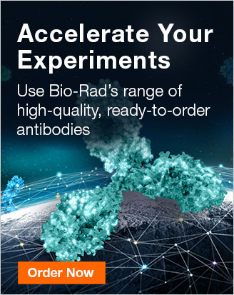 Accelerate your experiments - Use Bio-Rad’s range of high-quality, ready-to-order antibodies