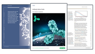 Antibody Advice Guide