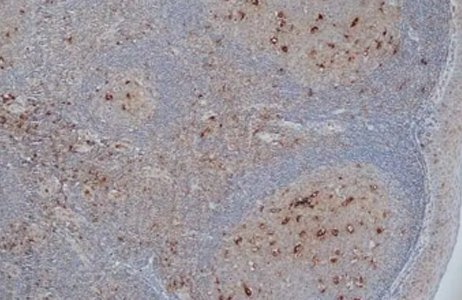 Fig. 2. Staining of formalin-fixed, paraffin-embedded human tonsil. 