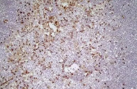 Fig. 4. Staining of a cryosection of mouse lymph node. 