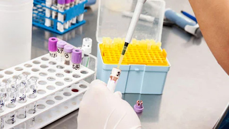 Sample Preparation in Flow Cytometry — Tips & Tricks Sample Preparation in Flow Cytometry — Tips & Tricks