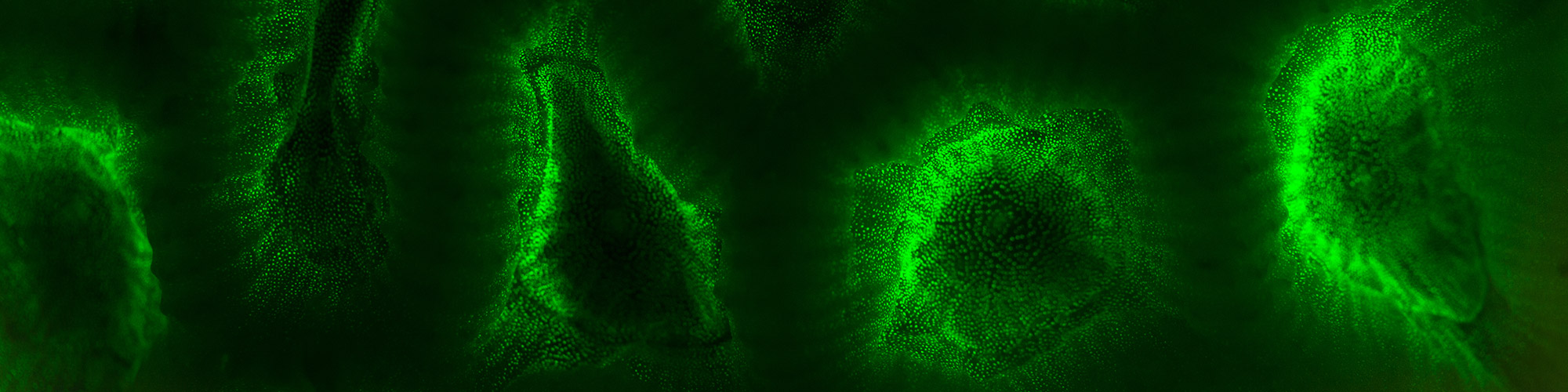 Illuminating Biomedical Research—The Story of Fluorescent Proteins