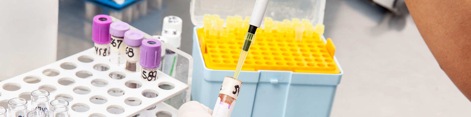Sample Preparation in Flow Cytometry — Tips & Tricks