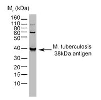 M. tuberculosis antibody