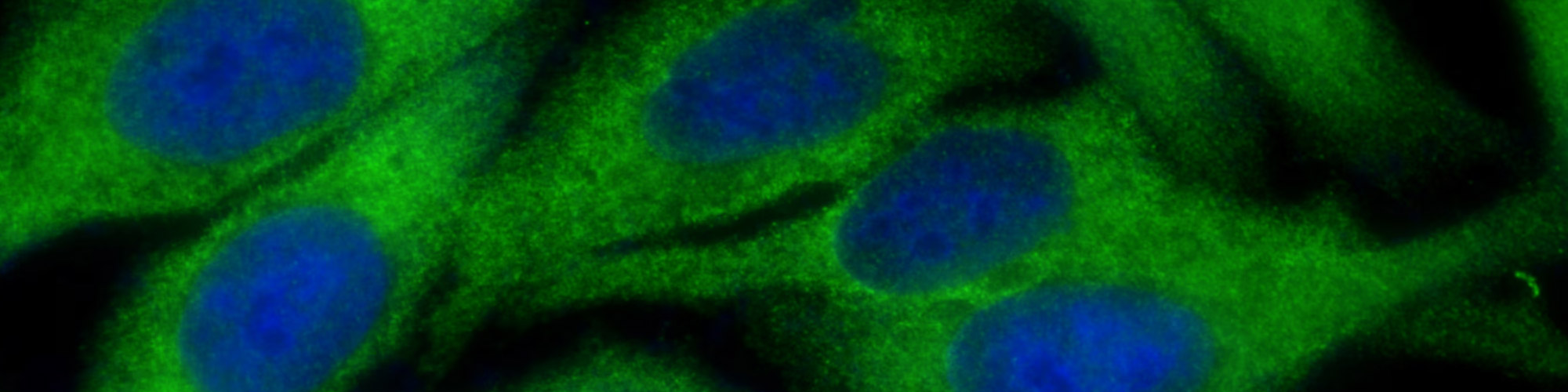 Ten Tips to Light Up Your Immunofluorescence Experiments 