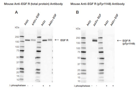 Fig. 1. Western blot analysis of A431 untreated and EGF treated whole cell lysates probed with (A) Mouse Anti-EGF R Antibody (cat. #VMA00061) or (B) Mouse Anti-EGF R (pTyr1148) Antibody (#VMA00751) followed by detection with HRP conjugated Goat Anti-Mouse IgG (1/10,000, #STAR207P). 