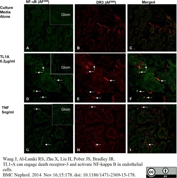 Rabbit Anti Human NFkB P65 Antibody | Bio-Rad