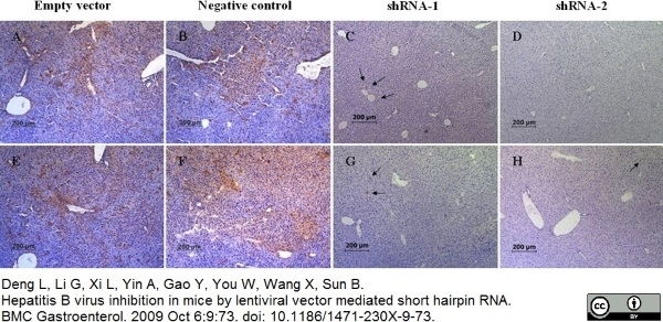 Anti Hepatitis B Surface Antigen Antibody | Bio-Rad Antibodies ...